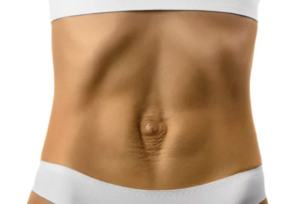 diastasis-recti-physiotherapy-propel-physiotherapy